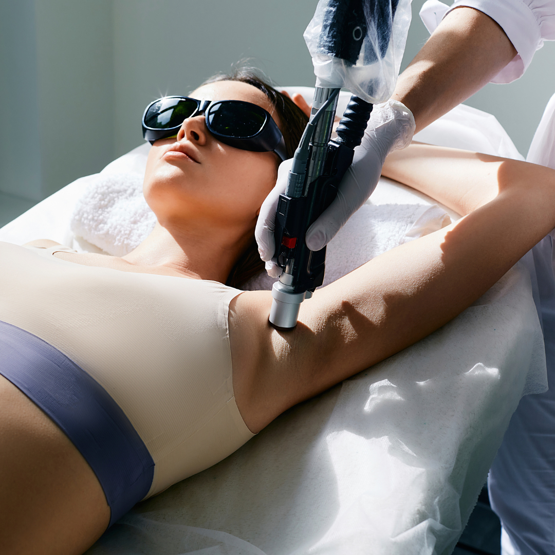 laser hair removal underarms
